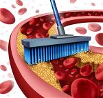 unclog-your-arteries-naturally