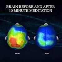 Não bộ trước và sau 10 phút thiền