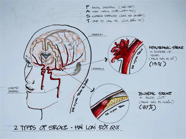 stroke dot quy 2